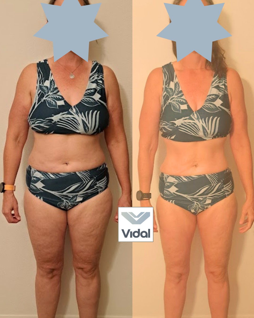 Jane: original before and after coaching photos