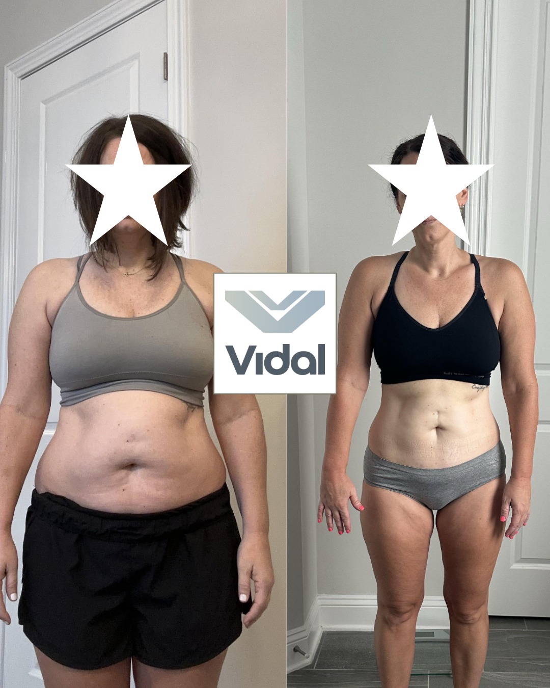 Original coaching comparison for a Vidal client, age 41